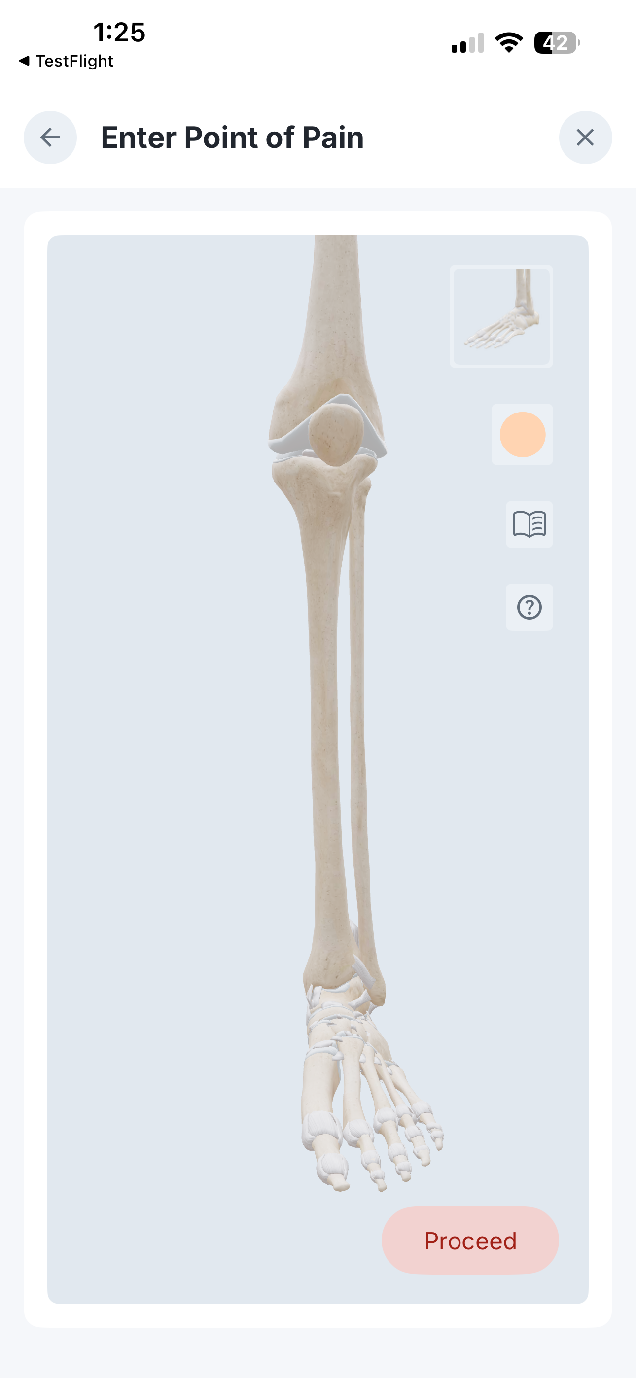 3D Anatomy Bone